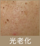 紫外線による光老化