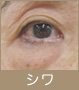 しわ