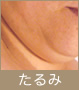 たるみ改善